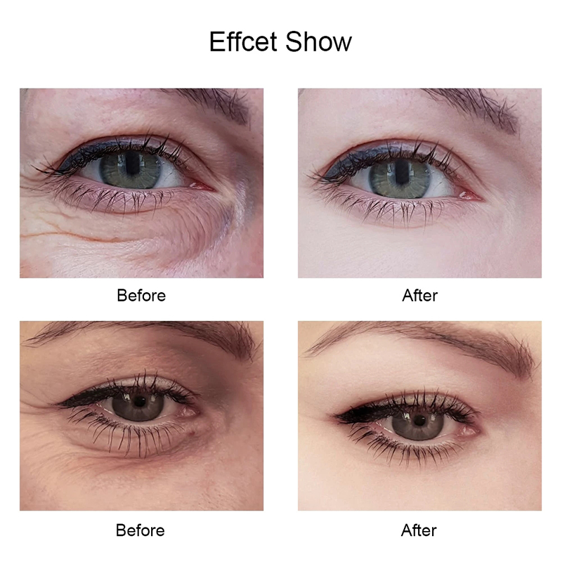 02ee5ea9 63b4 4370 a52c e3cd1b15a956 Moisturizing Eye Cream Improves Dark Circles