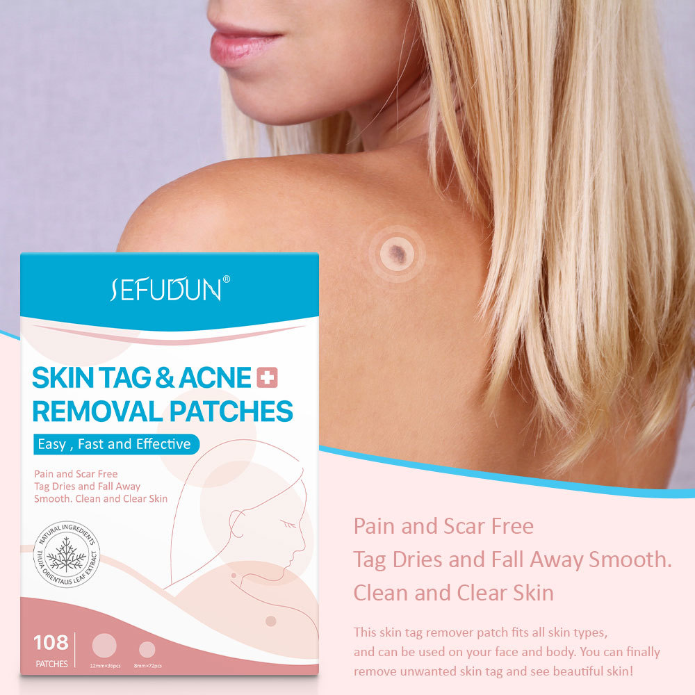 Buy Best & Cheap Skin Tag Remover
