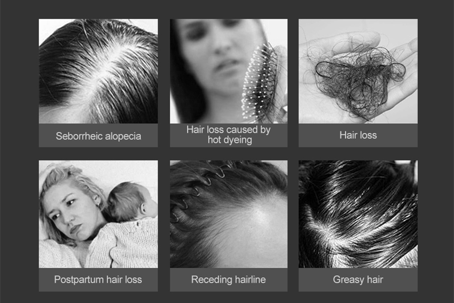 LESCOLTON LS-D601 Anti Hair Loss Laser Hair Regrowth Helmet for Hair Loss Medical Diodes Hair Regrow Treatment