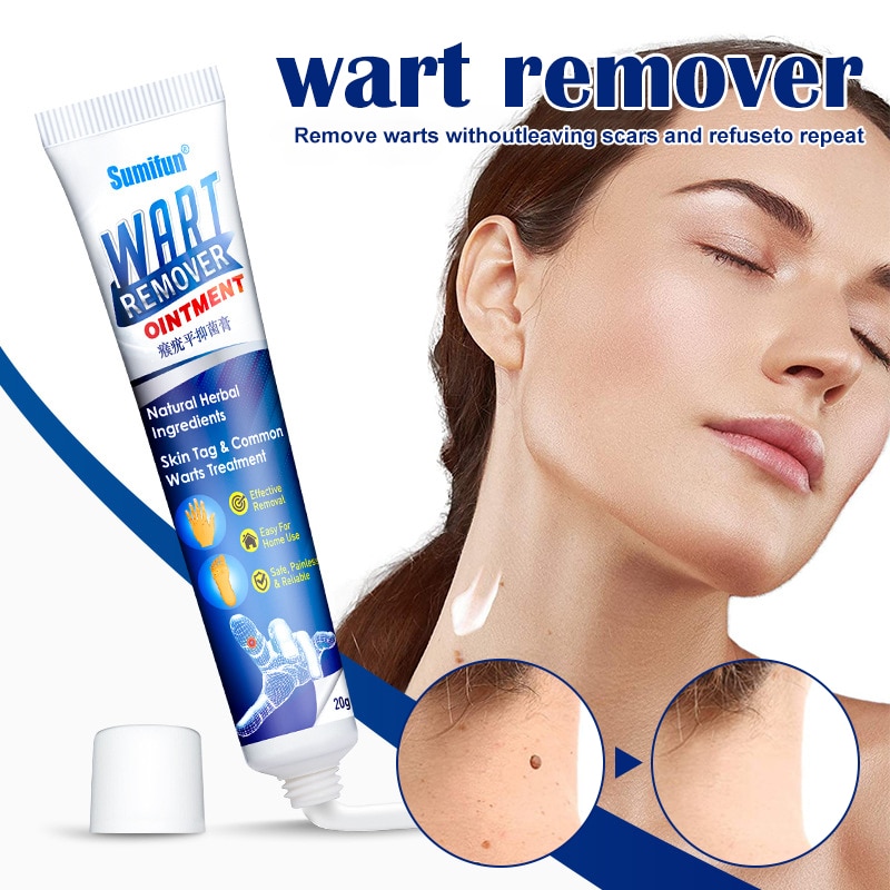 Warts Remover Antibacterial Ointment-Herbal Extract