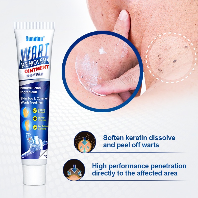 Warts Remover Antibacterial Ointment-Herbal Extract