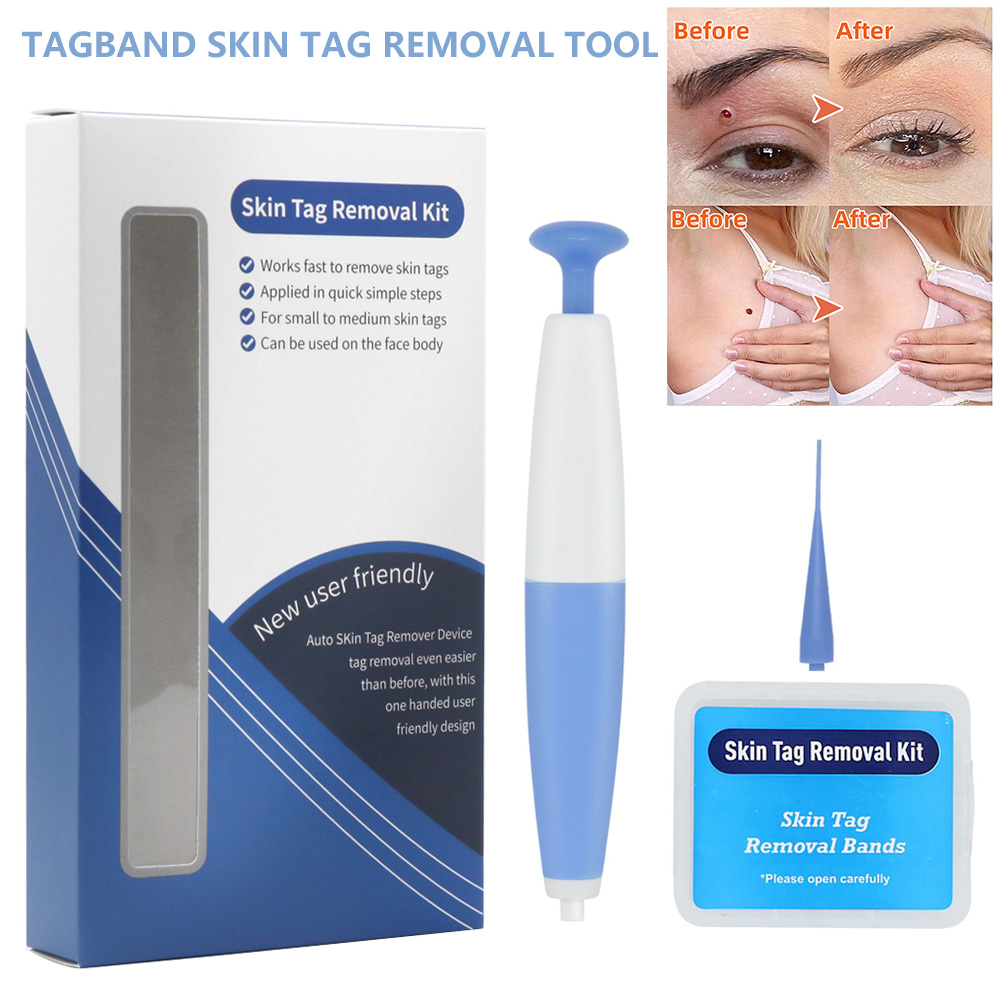 Skin Tag Removal Kit Home Use Mole Wart Remover Micro Band Skin Tag
