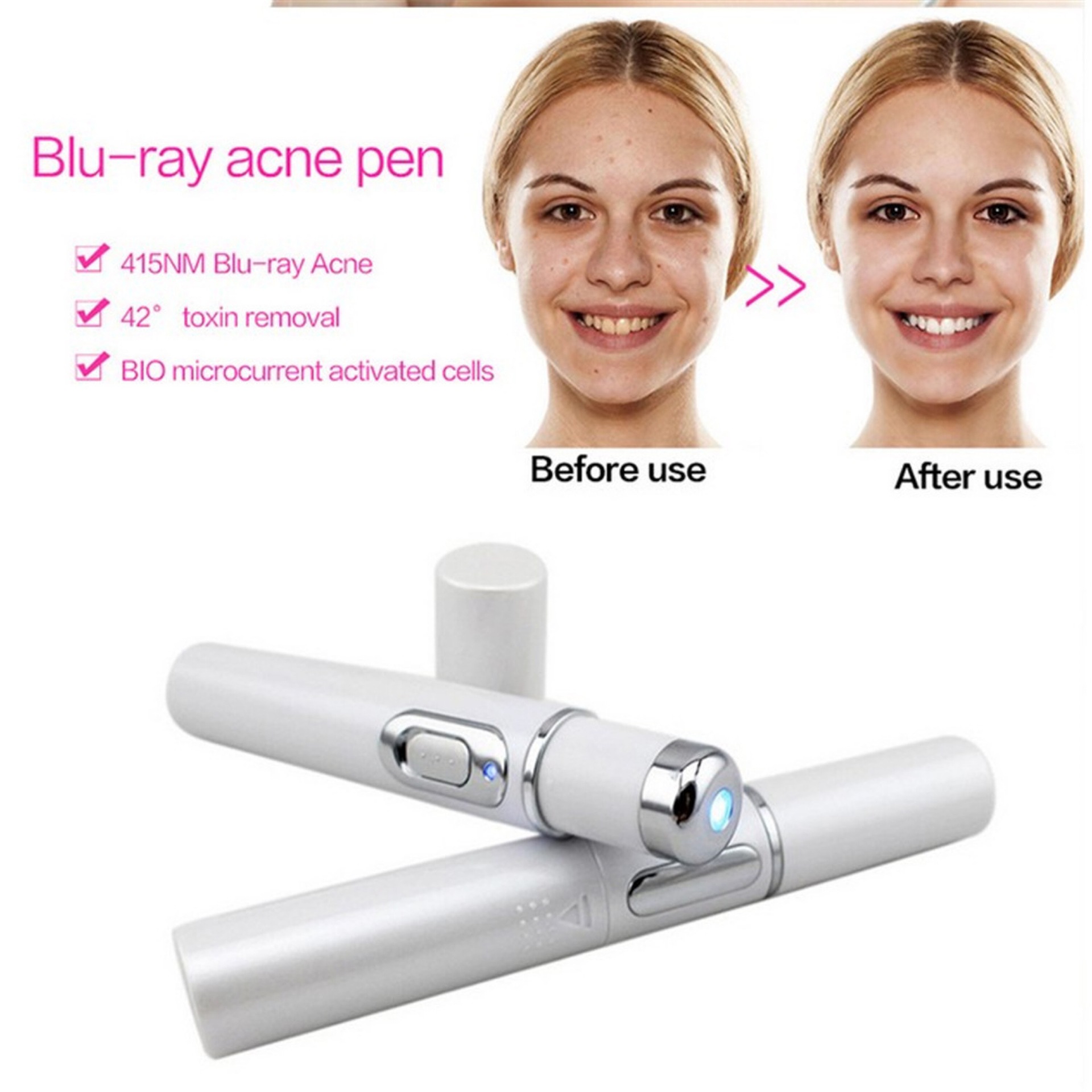 Instructions for use portable beauty pen for removing acne, scar, wrinkle, skin blemish, pimples, swelling zits, redness, inflammation