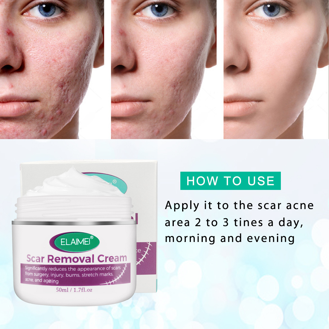 Skin Rebound Scarless Cream Scar Removal Cream Face Cream For Face Acne Scar Stretch Marks Skin Repair Face Cream